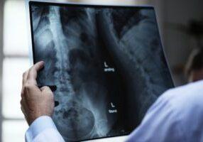 Reasonable Accommodation for Injured Workers